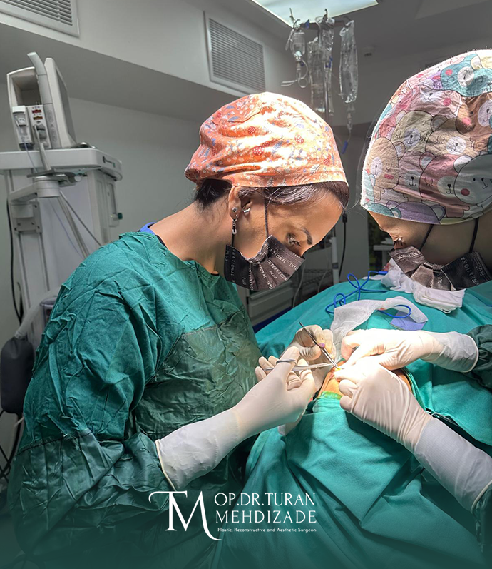 Dr. Turan Mehdizade Rhinoplasty